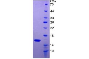 SDS-PAGE of Protein Standard from the Kit  (Highly purified E. (GDF2 ELISA Kit)