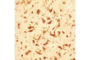 Macrophages stained with ABIN119773 using enhanced DAB in experimental allergic marmoset brain. (S100A8/A9 Complex (Calprotectin) antibody)