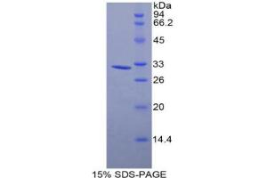 SDS-PAGE analysis of Mouse MYLK3 Protein. (MYLK3 Protein)
