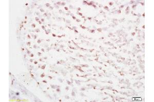 Formalin-fixed and paraffin embedded rat testis tissue labeled with Anti RBBP6/P2P-R Polyclonal Antibody, Unconjugated (ABIN687202) at 1:200 followed by conjugation to the secondary antibody and DAB staining (RBBP6 antibody  (AA 2-150))