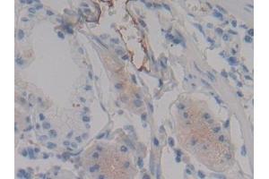 Detection of FGA in Human Stomach Tissue using Polyclonal Antibody to Fibrinogen Alpha Chain (FGA) (FGA antibody  (AA 124-214))