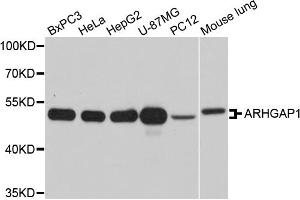 Western blot analysis of extracts of various cell lines, using ARHGAP1 antibody (ABIN5971927) at 1/1000 dilution. (ARHGAP1 antibody)