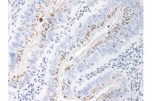 Image no. 1 for anti-Chemokine (C-X-C Motif) Ligand 2 (CXCL2) antibody (ABIN465915) (CXCL2 antibody)