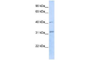 WB Suggested Anti-STUB1 Antibody Titration:  0. (STUB1 antibody  (C-Term))