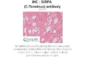 Image no. 2 for anti-Signal-Regulatory Protein alpha (SIRPA) antibody (ABIN1739273) (SIRPA antibody)
