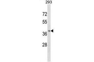 Western Blotting (WB) image for anti-Chemokine (C-C Motif) Receptor-Like 2 (CCRL2) (AA 205-234), (Middle Region) antibody (ABIN951139)