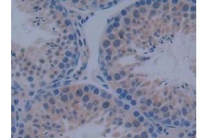 Detection of IkBd in Mouse Testis Tissue using Polyclonal Antibody to Inhibitory Subunit Of NF Kappa B Delta (IkBd) (IkBd antibody  (AA 58-304))