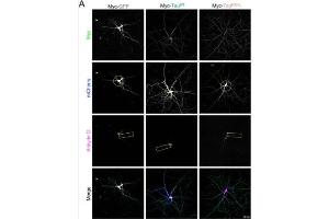Representative confocal images showing the morphology of DIV21 primary hippocampal neurons over-producing mCherry (blue, circle highlights the complexity in panel 2, i.
