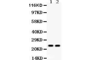 Anti- Mad2L1 Picoband antibody, Western blotting All lanes: Anti Mad2L1  at 0.