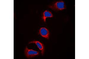 Immunofluorescent analysis of c-CBL (pY700) staining in HeLa cells.