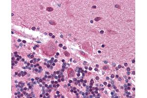 Anti-FYN antibody IHC of human brain, cerebellum.