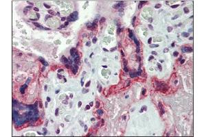 Human Placenta: Formalin-Fixed, Paraffin-Embedded (FFPE) (MMP3 antibody  (Ser373))
