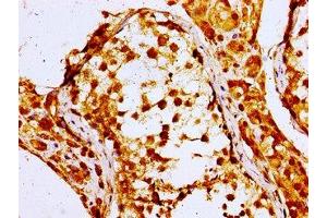 Immunohistochemistry of paraffin-embedded human testis tissue using ABIN7161727 at dilution of 1:100 (NPC1 antibody  (AA 23-269))