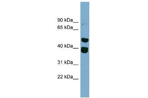 WB Suggested Anti-TRIM49 Antibody Titration: 0.