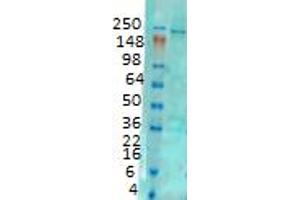 Western Blotting (WB) image for anti-Inositol 1,4,5-Trisphosphate Receptor, Type 1 (ITPR1) (C-Term) antibody (ABIN6658135)