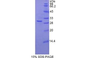 SDS-PAGE analysis of Rat TNNT1 Protein.
