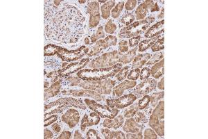 Immunohistochemical analysis of (ABIN656404 and ABIN2845698) on paraffin-embedded Human kidney tissue. (WFDC1 antibody  (C-Term))