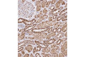 Immunohistochemical analysis of (ABIN656404 and ABIN2845698) on paraffin-embedded Human kidney tissue. (WFDC1 antibody  (C-Term))