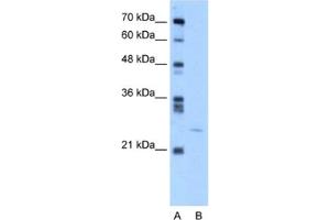 Western Blotting (WB) image for anti-YEATS Domain Containing 4 antibody (ABIN2460178) (GAS41 antibody)