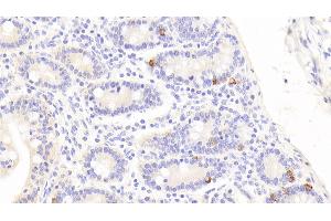 Detection of CTGF in Human Small intestine Tissue using Polyclonal Antibody to Connective Tissue Growth Factor (CTGF) (CTGF antibody  (AA 248-349))