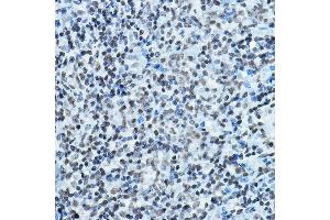 Immunohistochemistry of paraffin-embedded rat spleen using K Rabbit pAb (ABIN6128005, ABIN6142689, ABIN6142690 and ABIN6221516) at dilution of 1:100 (40x lens). (MYST2 antibody  (AA 55-193))