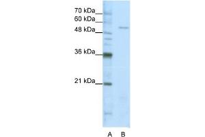 WB Suggested Anti-SARS Antibody Titration:  1. (Seryl-tRNA Synthetase (SARS) (Middle Region) antibody)