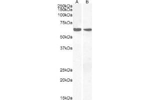 ABIN185382 (2µg/ml) staining of Human Thymus (A) and Human Lymph node (B) lysates (35µg protein in RIPA buffer). (PPP2R1A antibody  (C-Term))