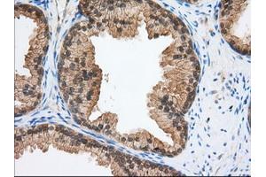 Immunohistochemistry (IHC) image for anti-Transforming, Acidic Coiled-Coil Containing Protein 3 (TACC3) antibody (ABIN1498098) (TACC3 antibody)