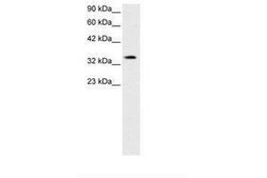 Image no. 2 for anti-PRKC, Apoptosis, WT1, Regulator (PAWR) (AA 212-261) antibody (ABIN202286)