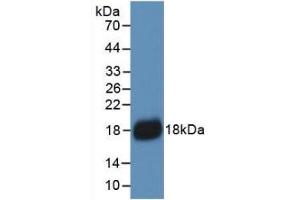 Detection of Recombinant IL18, Human using Monoclonal Antibody to Interleukin 18 (IL18) (IL-18 antibody  (AA 37-193))