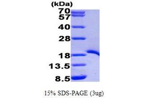 SDS-PAGE (SDS) image for TNF Receptor-Associated Factor 1 (TRAF1) (AA 266-416) protein (His tag) (ABIN667006)