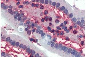 Small intestine,Human: Formalin-Fixed, Paraffin-Embedded (FFPE) (CDK1 antibody)