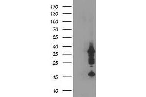Western Blotting (WB) image for anti-PDZ and LIM Domain 2 (PDLIM2) antibody (ABIN1500123) (PDLIM2 antibody)