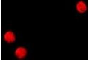 Immunofluorescent analysis of TSHZ2 staining in HeLa cells. (TSHZ2 antibody  (C-Term))