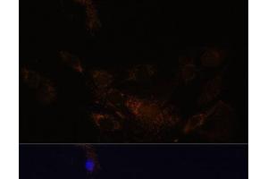 Immunofluorescence analysis of C6 cells using PSMB7 Polyclonal Antibody at dilution of 1:100 (40x lens). (PSMB7 antibody)