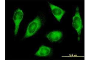Immunofluorescence of purified MaxPab antibody to HARS on HeLa cell. (HARS1/Jo-1 antibody  (AA 1-509))