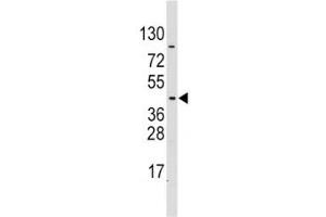 Western blot analysis of PDK4 antibody and CEM lysate (PDK4 antibody  (AA 250-277))