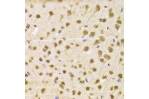 Immunohistochemistry of paraffin-embedded Mouse brain using RBFOX3 antibody at dilution of 1:100 (x400 lens).