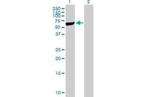 Western Blot analysis of STK40 expression in transfected 293T cell line by STK40 MaxPab polyclonal antibody. (STK40 antibody  (AA 1-435))