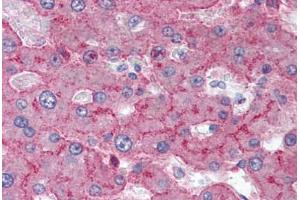 Human Liver (formalin-fixed, paraffin-embedded) stained with LRP1 antibody ABIN337070 at 5-10 ug/ml followed by biotinylated anti-mouse IgG secondary antibody ABIN481714, alkaline phosphatase-streptavidin and chromogen. (LRP1 antibody)