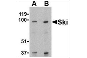 Western blot analysis of Ski in human kidney tissue lysate with this product at (A) 1 and (B) 2 μg/ml.