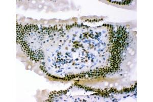IHC analysis of p95 NBS1 using anti-p95 NBS1 antibody (ABIN3043282).