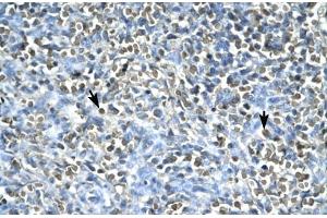 Human Spleen; ASGR2 antibody - N-terminal region in Human Spleen cells using Immunohistochemistry (Asialoglycoprotein Receptor 2 antibody  (N-Term))