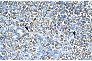 Human Spleen; ASGR2 antibody - N-terminal region in Human Spleen cells using Immunohistochemistry