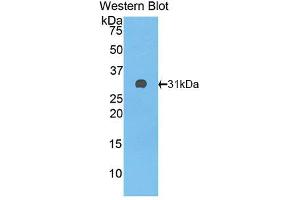 Western blot analysis of the recombinant protein. (Complement Factor H antibody  (AA 915-1156))