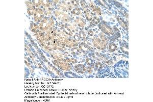 Rabbit Anti-RAD23A Antibody  Paraffin Embedded Tissue: Human Kidney Cellular Data: Epithelial cells of renal tubule Antibody Concentration: 4. (RAD23A antibody  (Middle Region))