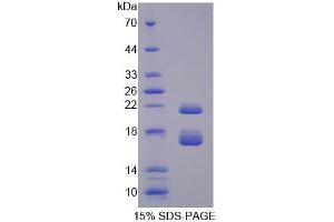 SDS-PAGE (SDS) image for Chibby Homolog 1 (CBY1) (AA 7-127) protein (His tag) (ABIN4989197)