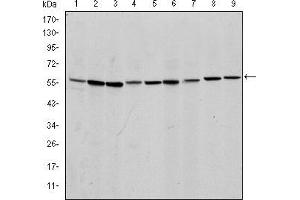 Western blot analysis using AIF mouse mAb against NIH/3T3 (1), Jurkat (2), Hela (3), HepG2 (4), MOLT4 (5), C6 (6), RAJI (7), Cos7 (8) and PC-12 (9) cell lysate. (AIF antibody)