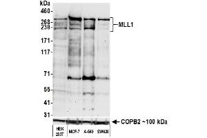 anti-Myeloid/lymphoid Or Mixed-Lineage Leukemia 1 (MLL1) (AA 720-780) antibody