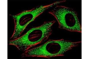 Fluorescent image of HeLa cells stained with FGFR2 antibody at 1:25 dilution. (FGFR2 antibody  (AA 7-37))